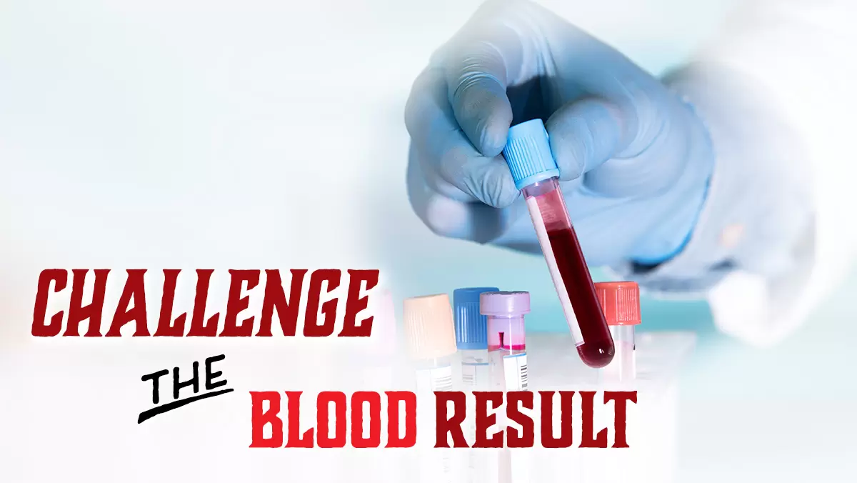 How to Challenge DWI Blood Test